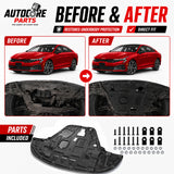 AutoCore Parts Front Engine Splash Shield Case Guard Under Cover with Screw Hardware Compatible with 2021-2025 Kia K5 | Direct Replacement | 29110L3000 | 29110-L3000